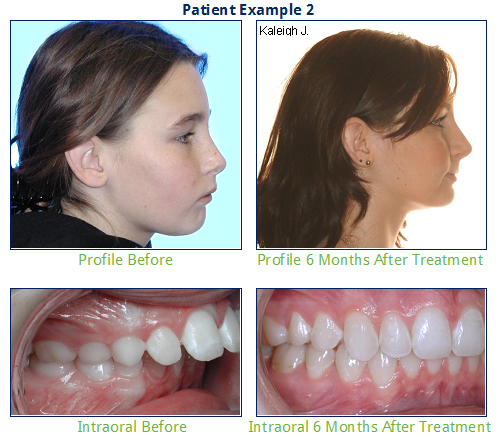 2-Phase Ortho Pt2.jpg